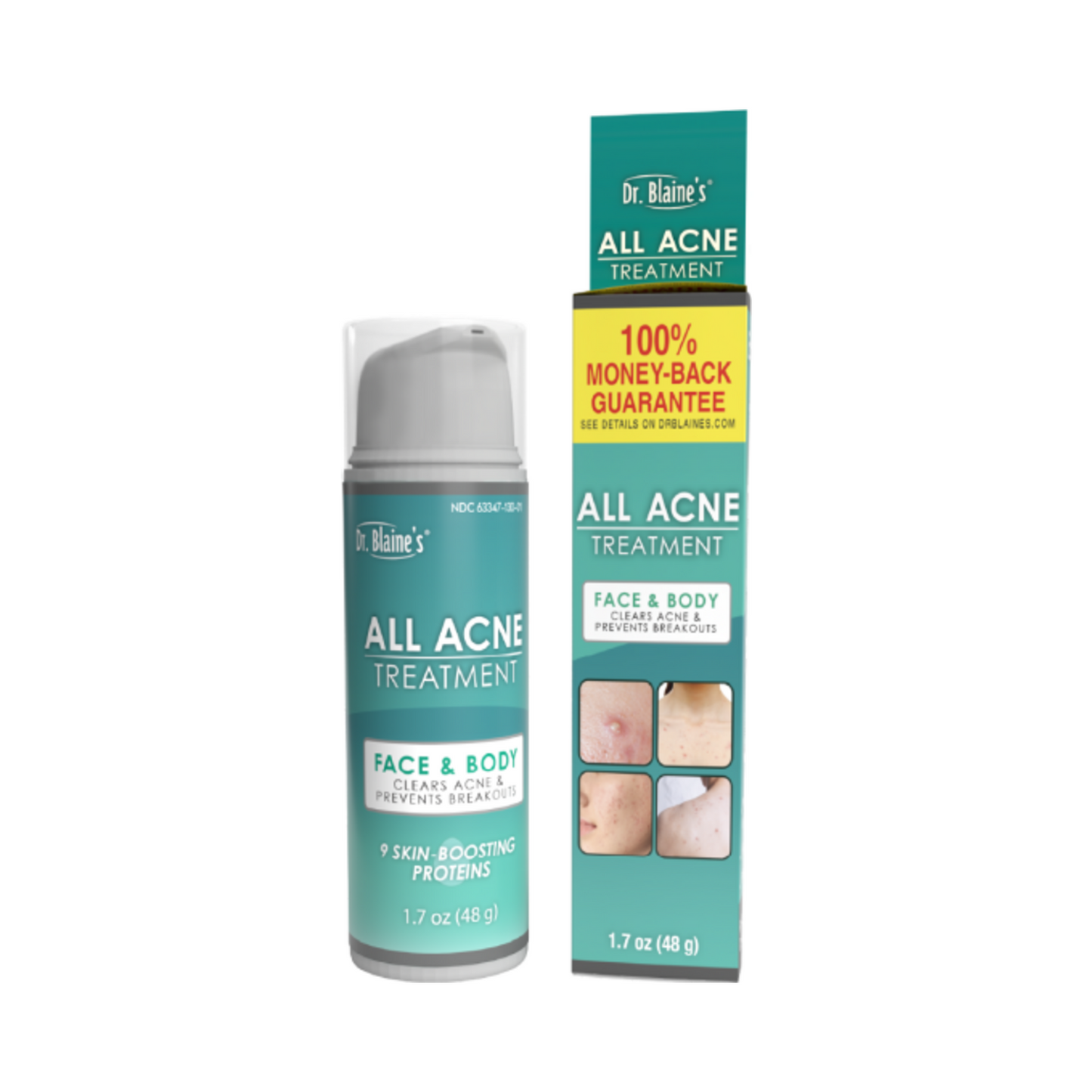 Dr.Blaines al acne -behandling