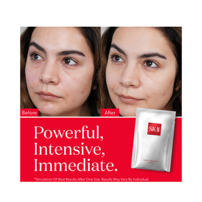 SK-II Pitera Gesichtsbehandlungsmaske, Doppelpack